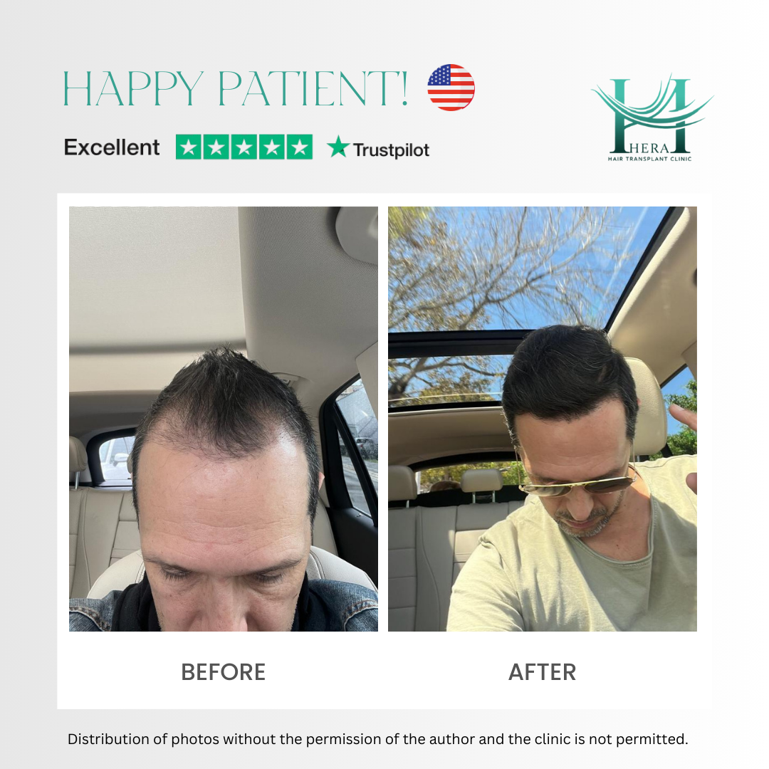 hera hair solutions before and after photo 8