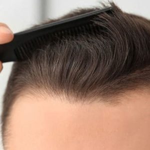 Do hair transplants look natural?