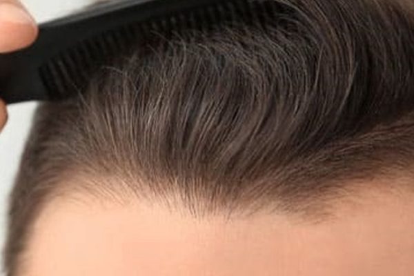 Do hair transplants look natural?