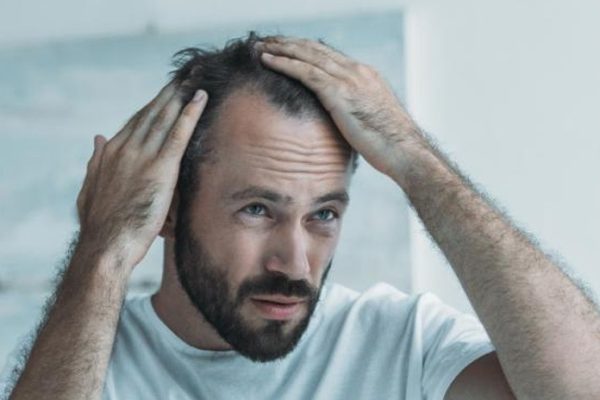 Reason of Hair Loss