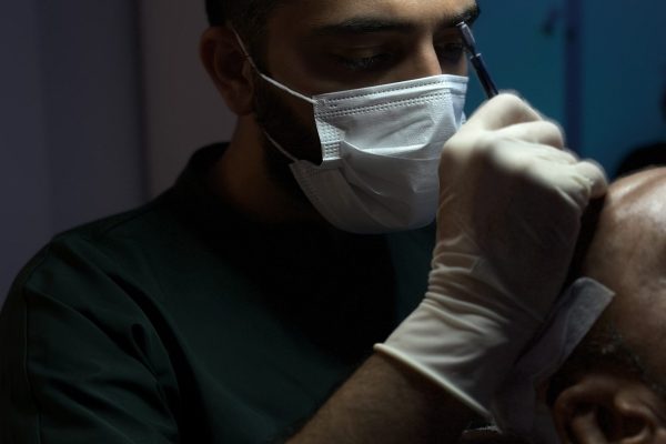 Which Hair Transplant Technique Is Best? A Guide for Natural Results