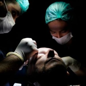 Why Turkey is the Premier Destination for Hair Transplant Surgery