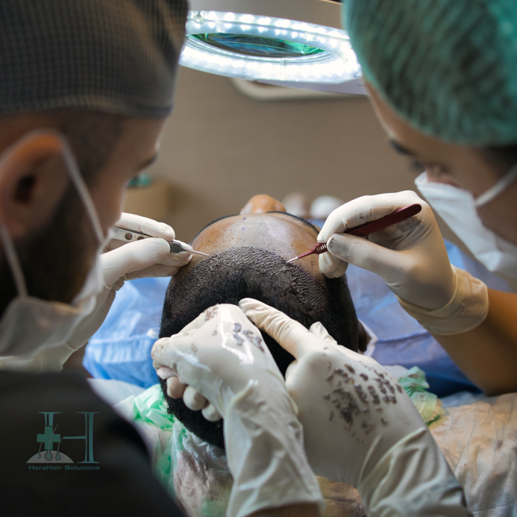 hair transplantation technique