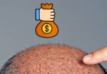 Best Price for Hair Transplant Hair Transplant Cost