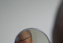 Is Hair Transplant Permanent? Is hair transplant permanent? See long-lasting results with FUE and DHI techniques at Hera Hair Solutions.