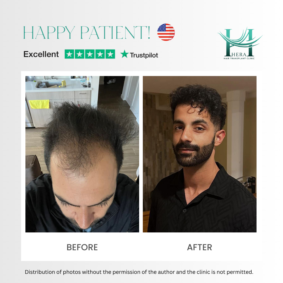 hera hair solutions before and after photo 10