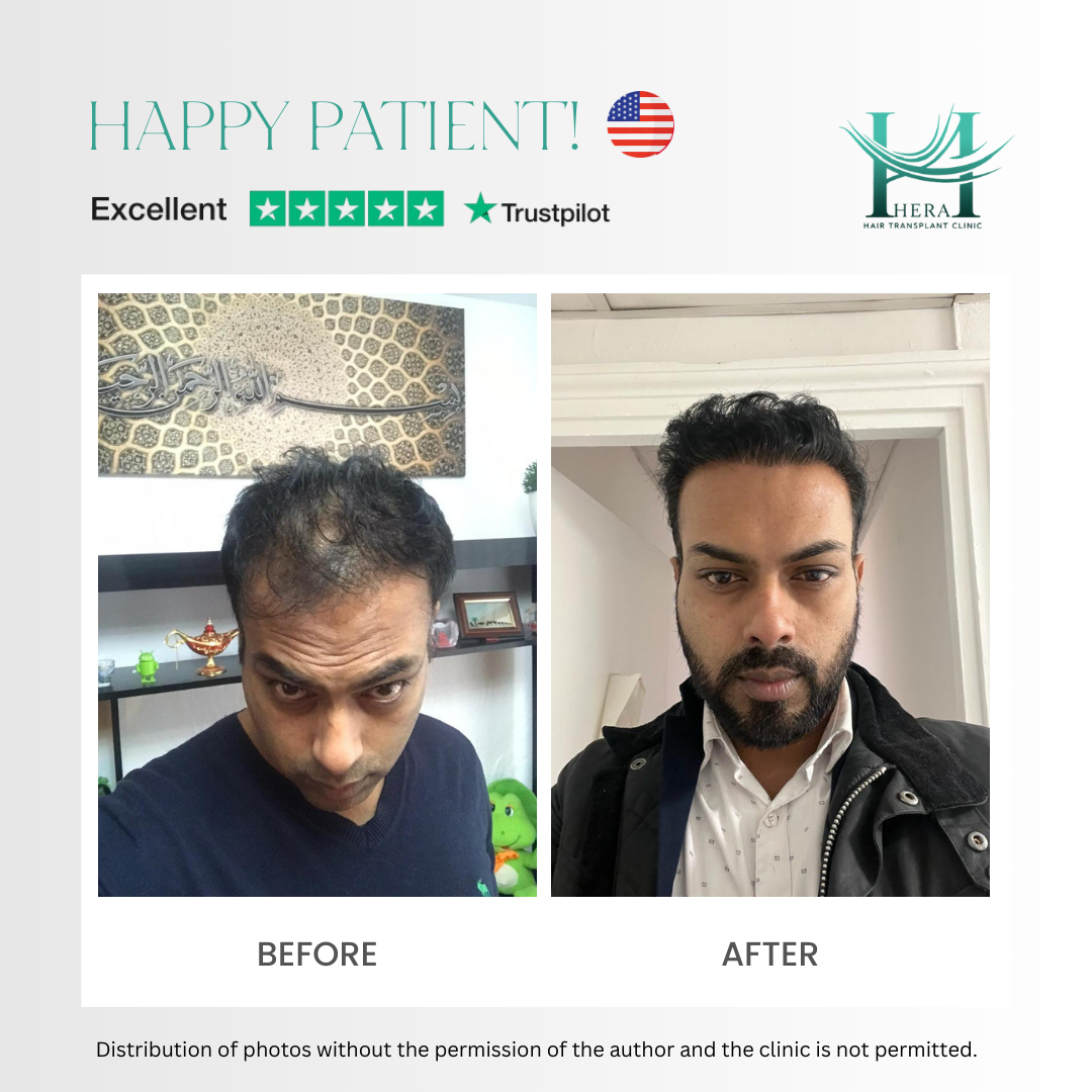 hera hair solutions before and after photo 4