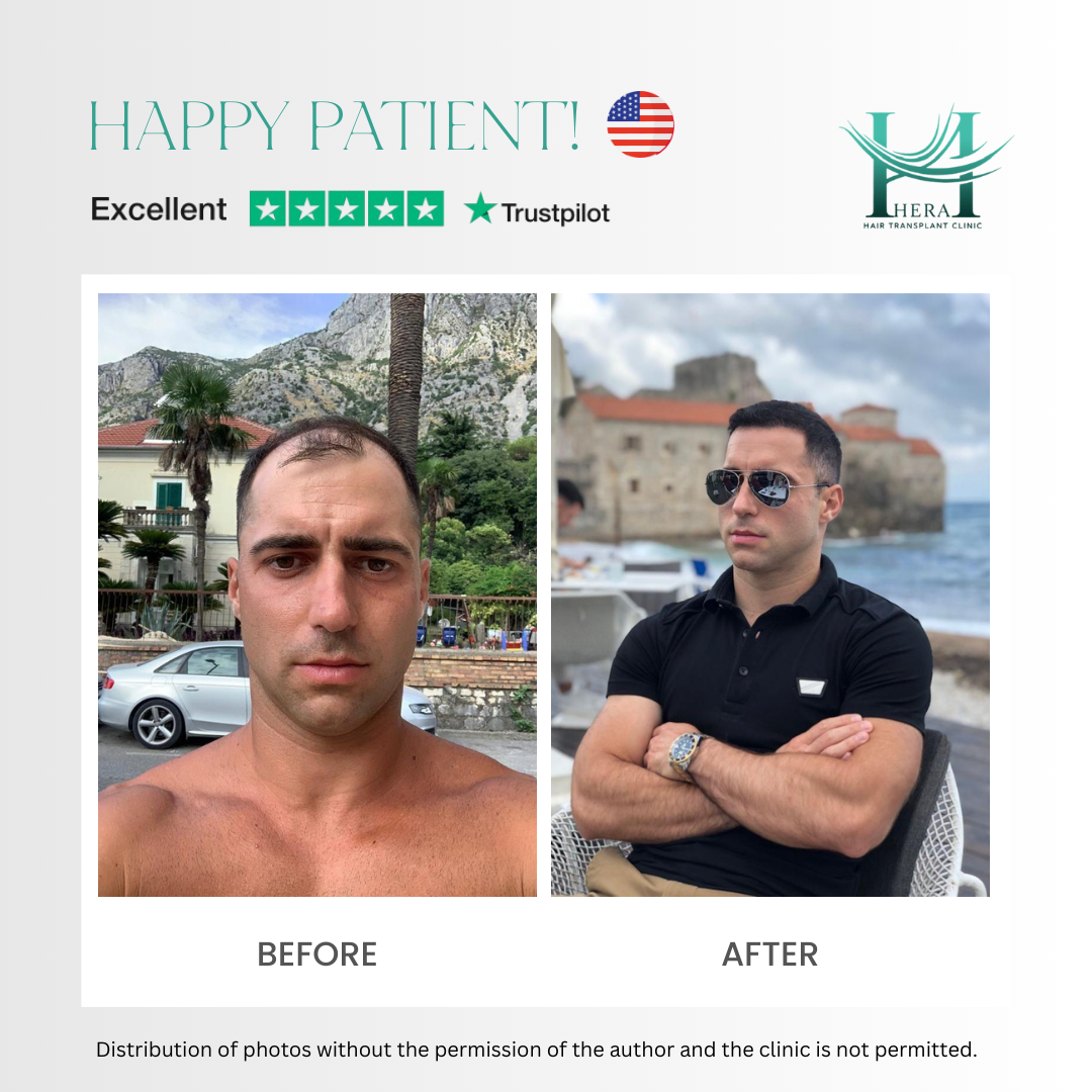 hera hair solutions before and after photo 7