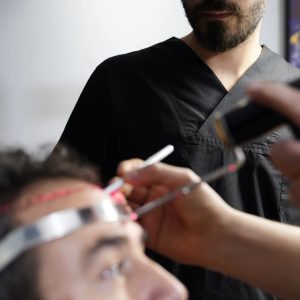 Is Hair Transplant Painful? Honest Answer from Experts